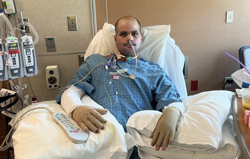 A nursing student trapped in a car fire suffered burns to half his body and endured 50 surgeries - now he helps other burn survivors find housing and hope.