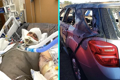 A nursing student trapped in a car fire suffered burns to half his body and endured 50 surgeries - now he helps other burn survivors find housing and hope.