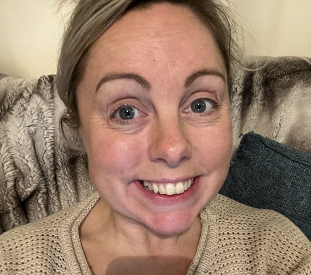 Mum Charlie Beswick woke up with slurred speech and a droopy face months before her wedding - she was diagnosed with Bell's Palsy and feared it could become permanent.