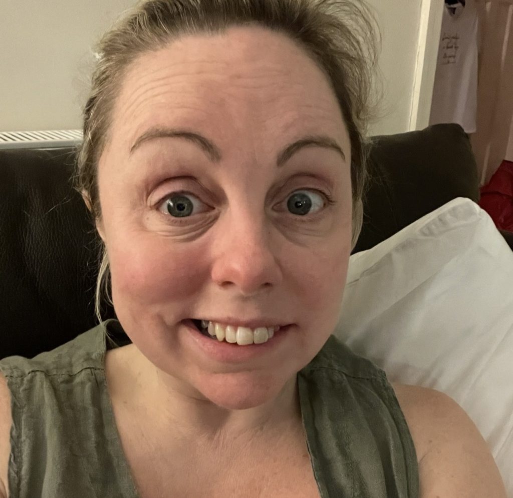 Mum Charlie Beswick woke up with slurred speech and a droopy face months before her wedding - she was diagnosed with Bell's Palsy and feared it could become permanent.