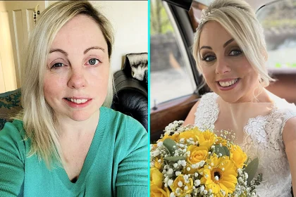 Mum Charlie Beswick woke up with slurred speech and a droopy face months before her wedding - she was diagnosed with Bell's Palsy and feared it could become permanent.