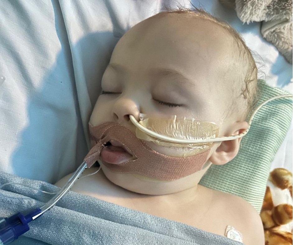A 22-month-old girl with no Covid symptoms suddenly collapsed and was diagnosed with a rare brain condition - leaving her parents watching her tiny body "turn to stone" overnight.