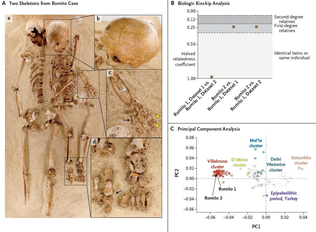 Ancient skeletons found embracing in an Italian cave were a mother and daughter with a rare form of dwarfism - DNA analysis reveals after more than 60 years of mystery.