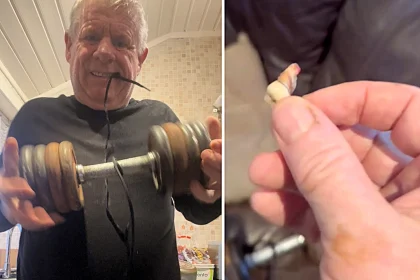 A man in agony pulled out his own tooth using weights and vodka after failing to access NHS care, as the UK dental crisis drives patients to desperate measures.