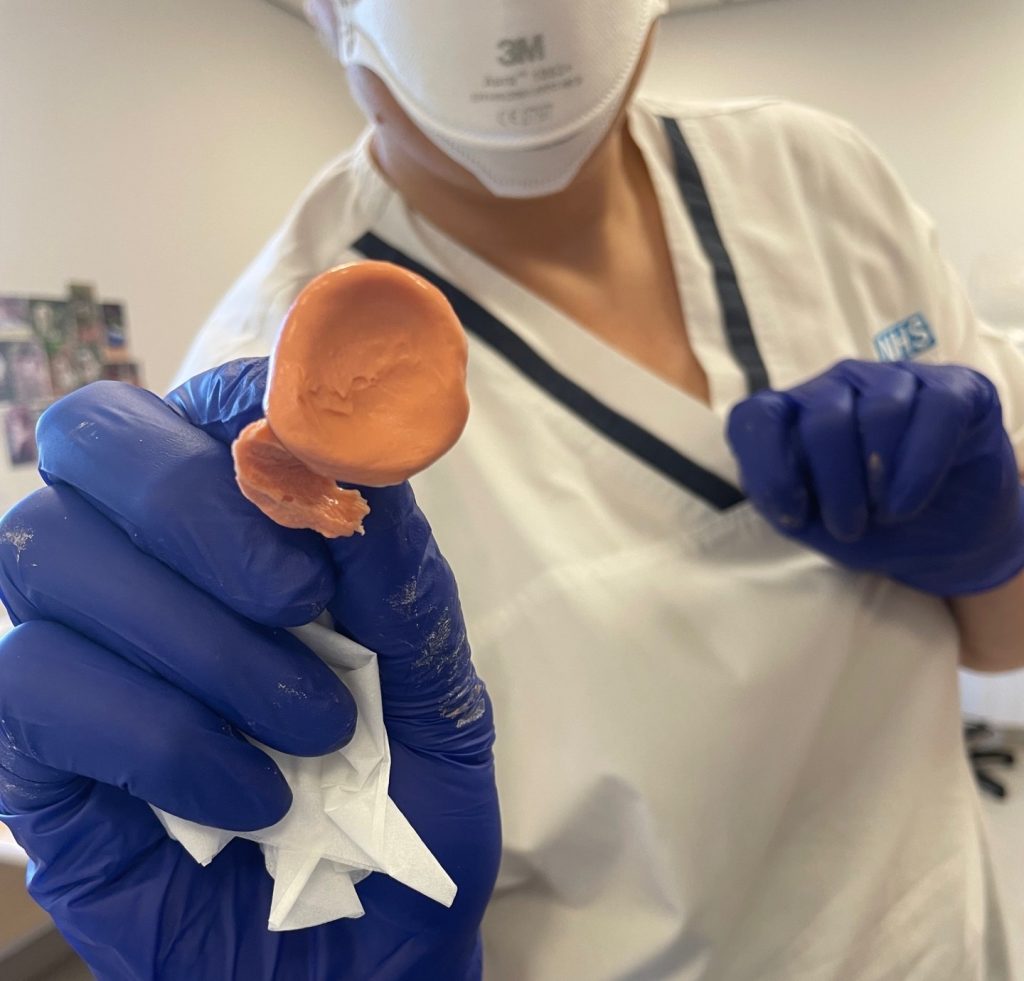 A British dad had his eyeball removed after a stranger's fingernail slashed his eye during a pool volleyball game on a family holiday in Mexico - leaving him blind in one eye.