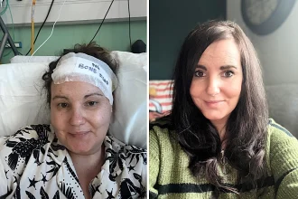 Mum's periods stopped and doctors blamed anxiety - but an MRI revealed a satsuma-sized brain tumour that had been growing for 20 years. She now needs a titanium skull plate.