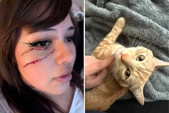 A sleeping cat owner nearly lost an eye after her pet maimed her face in the dead of night - but she still loves him and refuses to blame him for the freak accident.