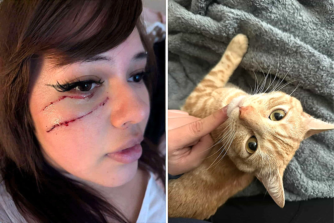 A sleeping cat owner nearly lost an eye after her pet maimed her face in the dead of night - but she still loves him and refuses to blame him for the freak accident.