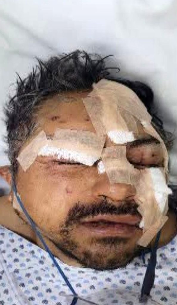 A drunk man was mauled by lions after jumping a fence and releasing six big cats from their cages at a Mexican zoo - then had to hide in a cage as they turned on him.