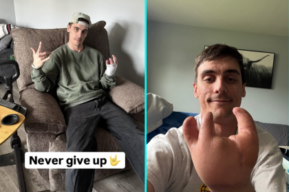 Factory worker Kyle Mazur had his hand sewn to his hip after all skin was ripped off in a horror accident - now he shares his incredible recovery to inspire others.
