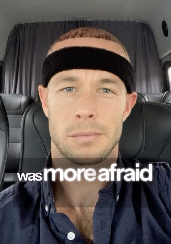 Firefighter nicknamed Baldilocks says he felt second best for years before a Turkey hair transplant changed his life - even inspiring him to quit his job and follow his dream.