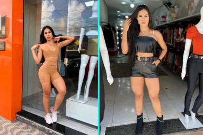 Influencer Derleya Alves dies aged 26 from complications after a boob job in Brazil - she suffered intense abdominal pain and underwent two emergency surgeries before passing.