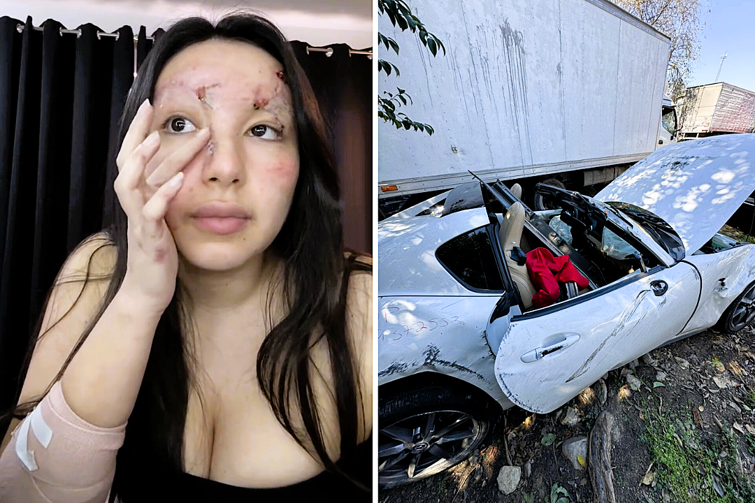 Influencer left with severe facial injuries after being flung from her car in a horror crash while speeding without a seatbelt - now sharing her recovery to warn others.