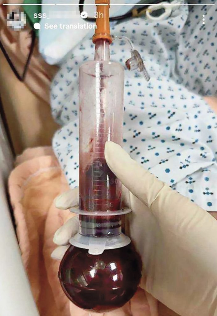 Nurse Liao Wan-ru has been suspended after allegedly posting disturbing photos of ICU patients on Instagram - including blood and faeces - while mocking them with offensive remarks.