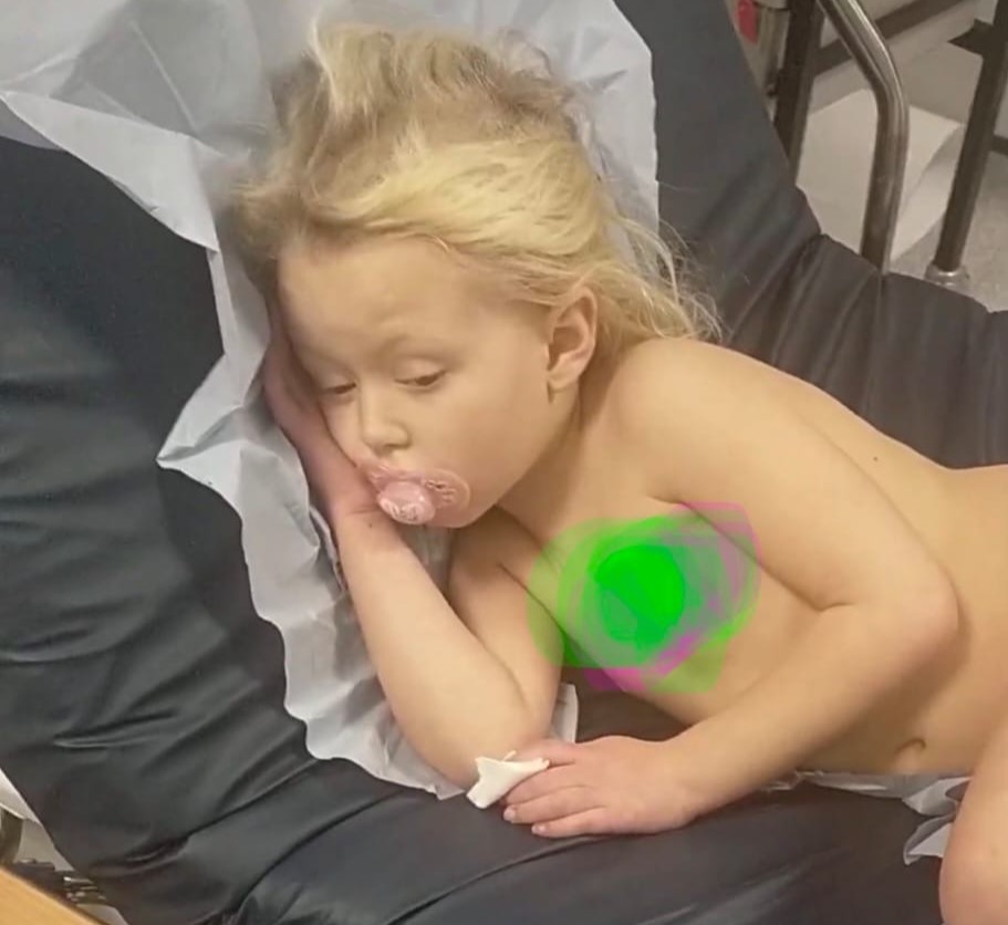 Mum shares terrifying moment daughter was struck by meningitis despite being fully vaccinated - leaving her with epilepsy and facing possible brain surgery in the future.