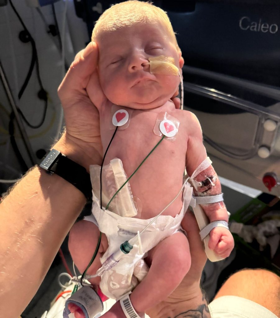Mum Emily Waterhouse shares her heartbreaking story after baby Carter died for eight minutes during surgery - just one week after her wedding day. Now he is finally thriving.