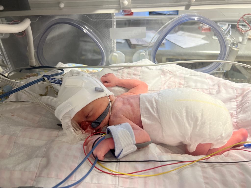 Mum Emily Waterhouse shares her heartbreaking story after baby Carter died for eight minutes during surgery - just one week after her wedding day. Now he is finally thriving.