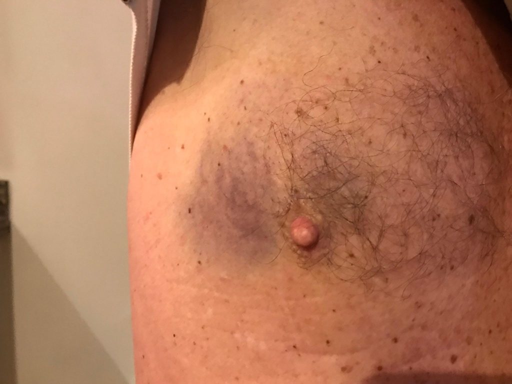 Retired probation officer Martin Dandridge was brutally beaten with a hockey stick by racehorse trainer Evan Williams while walking his dog - leaving him with PTSD and a broken arm.