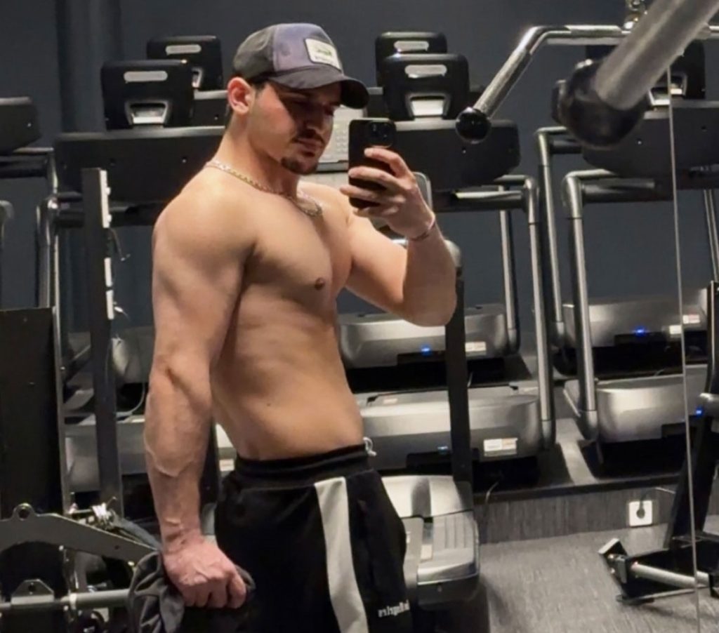 Farshid Esmaeili's leg was crushed at age 12 and doctors urged amputation - but after 27 surgeries he defied the odds and now lifts heavy weights at the gym every day.