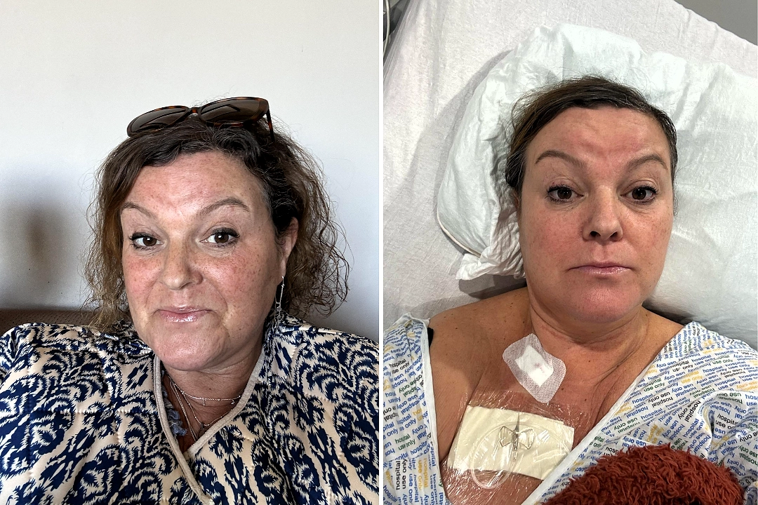Gail Redpath thought her symptoms were menopause but a golf ball-sized lump revealed rare terminal cancer. Now she is defying her months-to-live diagnosis with chemotherapy.