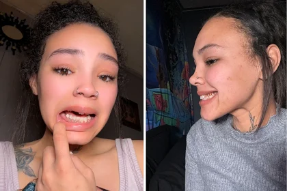 Mum says her teeth began deteriorating during pregnancy and now lives in constant agony as all her teeth need pulling out but she faces a massive bill without insurance.