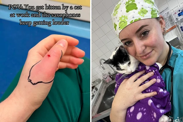 A veterinary nurse needed emergency surgery after a cat bite left her hand ballooned with infection - and is now warning others never to ignore animal bites.