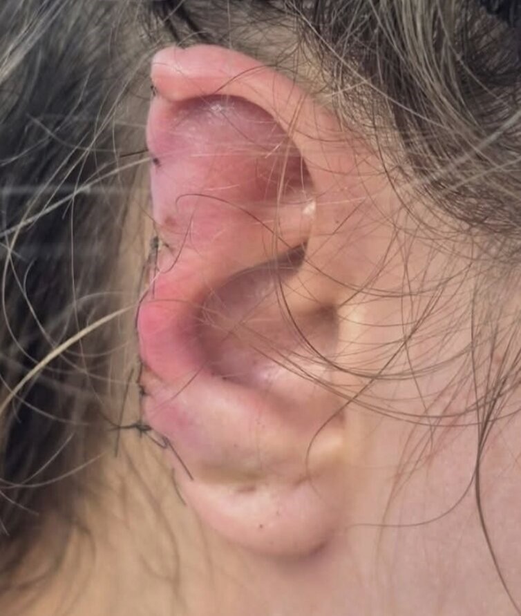 A Brazilian man was arrested after allegedly biting off part of his girlfriend's ear at a restaurant because she had spent too long in the bathroom queue at a music event.