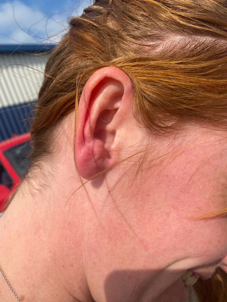 A business owner was deliberately knocked down by a white van after confronting thieves who had raided her premises in Oswestry, leaving her and her partner with injuries.