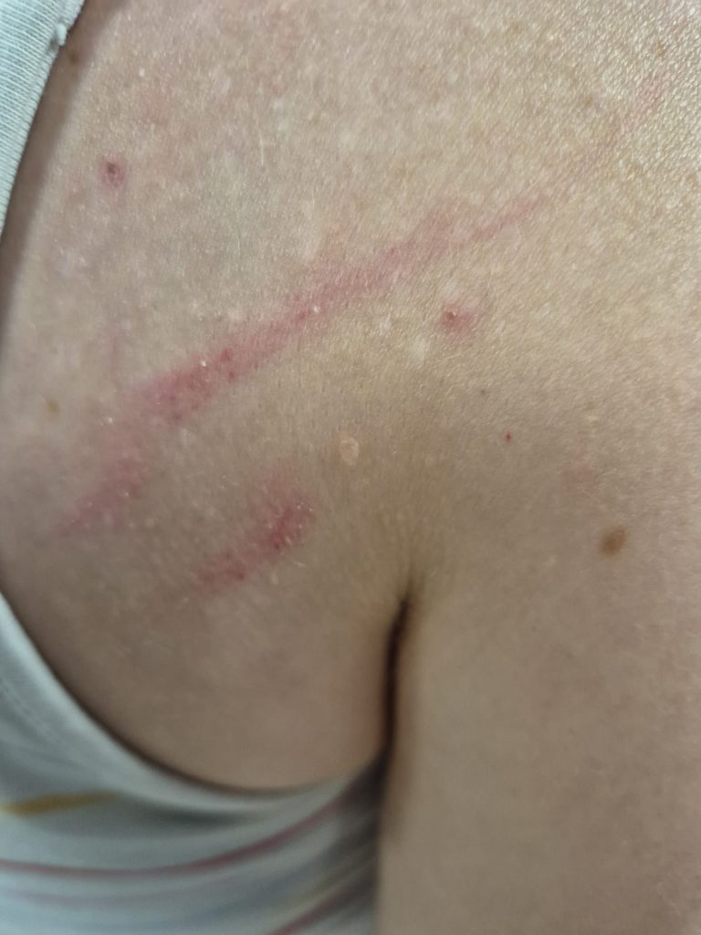 A business owner was deliberately knocked down by a white van after confronting thieves who had raided her premises in Oswestry, leaving her and her partner with injuries.