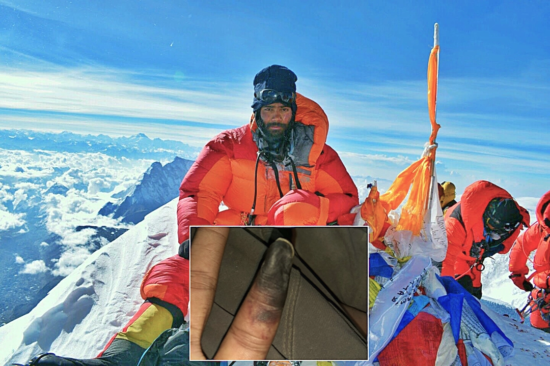 A mountaineer who scaled more than 30 peaks lost his finger on Everest after removing his glove for just four minutes in -35C conditions - and says the psychological toll was harder than the amputation.