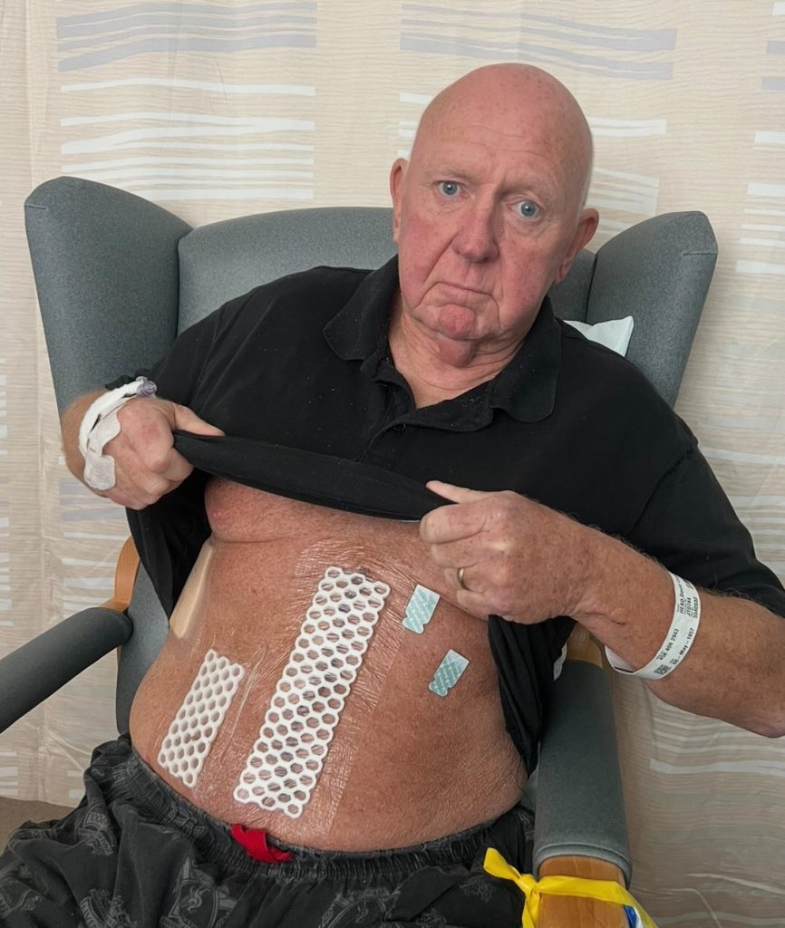 Leanne Head was battling aggressive breast cancer when her dad David was diagnosed too. They had chemo together and surgery just a day apart - their powerful survival story.