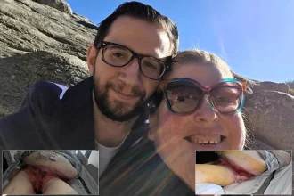 Husband desperately fundraising for wife Laura Abbott who is battling calciphylaxis - a rare and often fatal condition that causes agonising wounds linked to kidney disease.