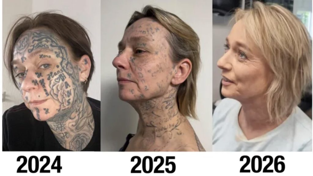 A woman says her abusive ex tattooed his name on her body over 250 times - including her face. A charity is now helping her remove every mark and reclaim her identity.