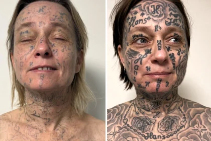 A woman says her abusive ex tattooed his name on her body over 250 times - including her face. A charity is now helping her remove every mark and reclaim her identity.