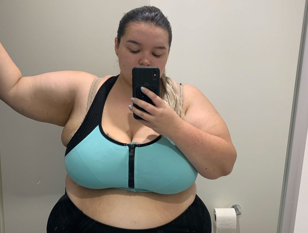 Quoted $100,000 for skin removal surgery after losing 187lbs, Codie McGovern flew 4,500 miles to Thailand and got it done for $28,000, and it changed everything.