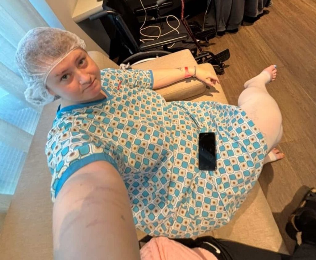 A woman woke up from surgery abroad to find her tattoos had vanished - and it was her boyfriend who spotted they were gone before she even noticed.