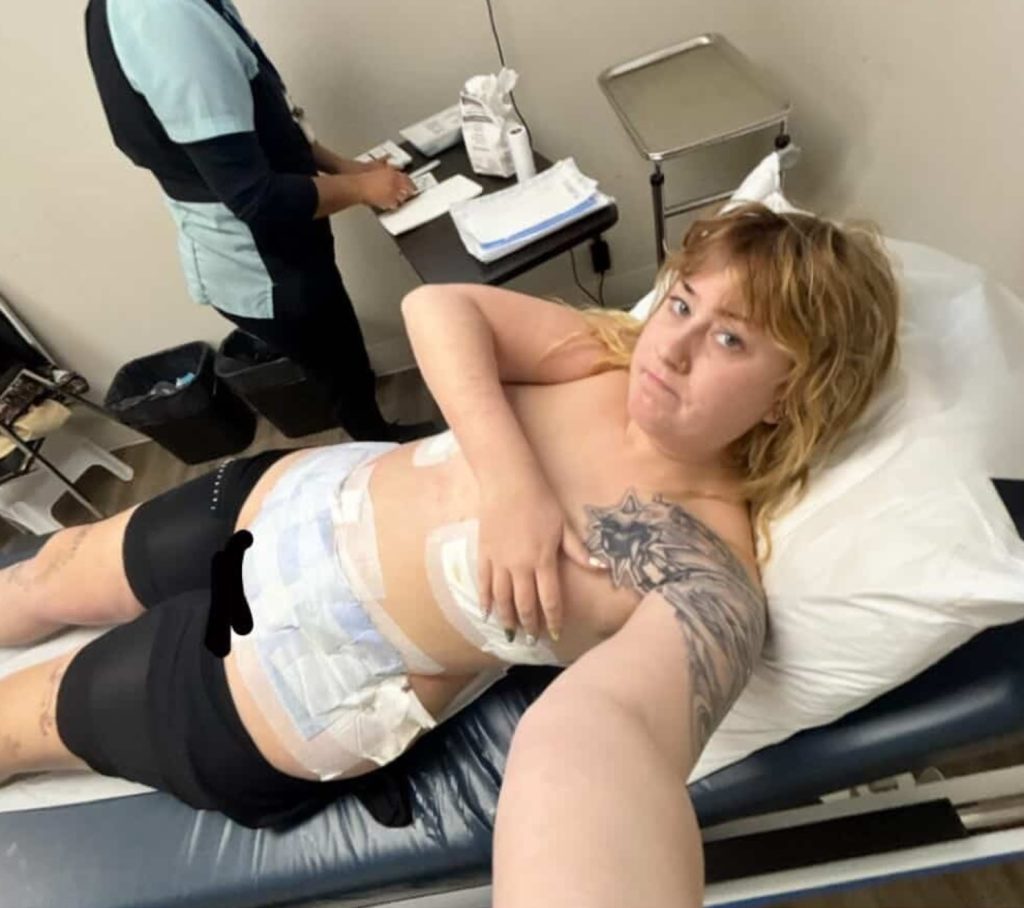 A woman woke up from surgery abroad to find her tattoos had vanished - and it was her boyfriend who spotted they were gone before she even noticed.