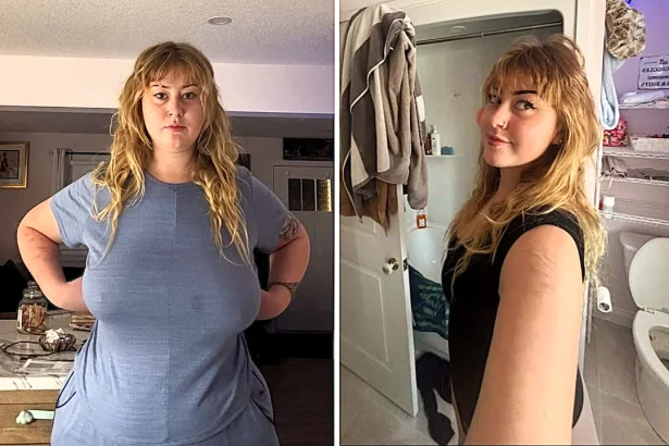 A woman woke up from surgery abroad to find her tattoos had vanished - and it was her boyfriend who spotted they were gone before she even noticed.