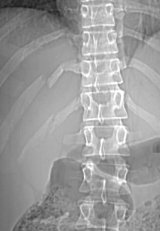 Beauty influencer Carolina Braedt broke three ribs after horror horse riding fall from her steed Igor - the 350k follower star calls the scary tumble an occupational hazard.