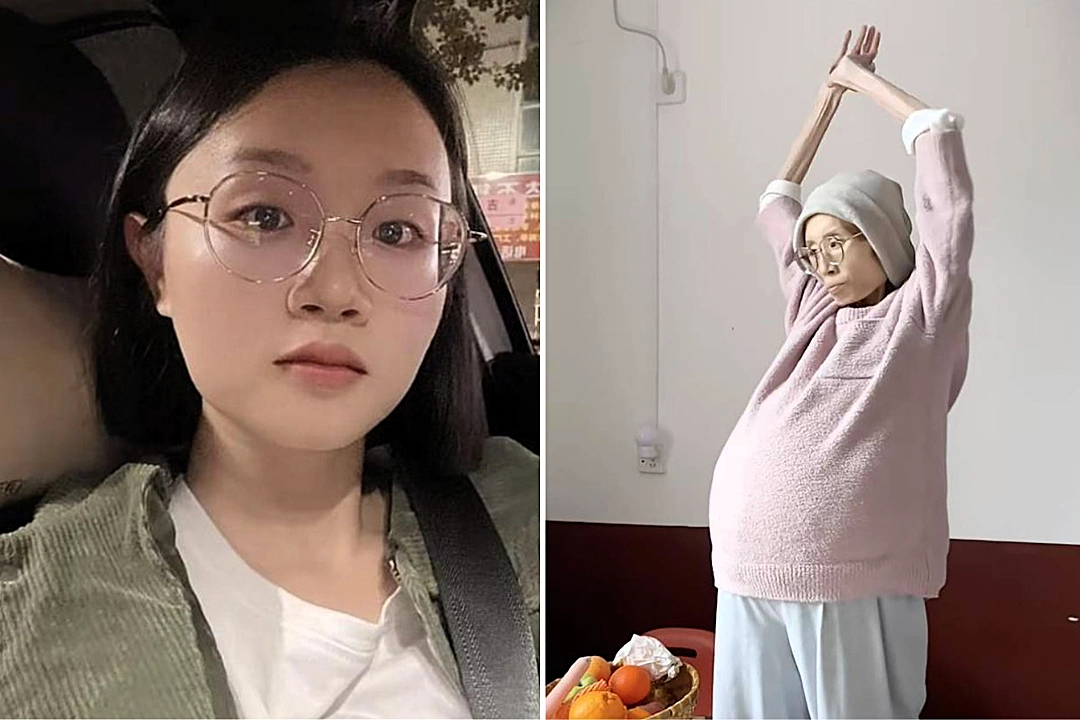 Chinese influencer Liao Dayan, dubbed the "Sunshine Girl", died aged 29 after inspiring 2.4 million followers with her courageous three-year battle against a rare abdominal cancer.