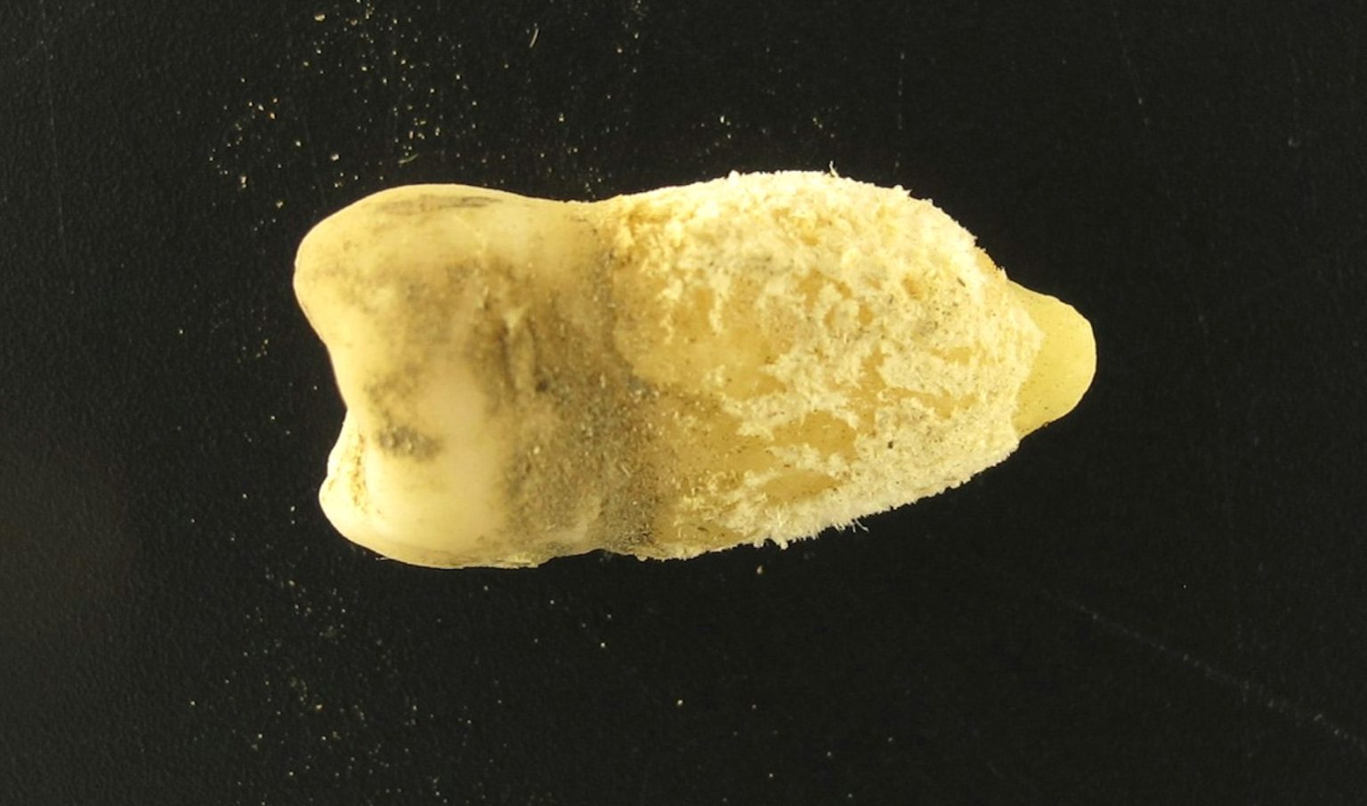Scientists have reconstructed a 700-year-old strep infection genome from a medieval tooth, revealing the deadly bacteria was infecting humans centuries earlier than previously known.