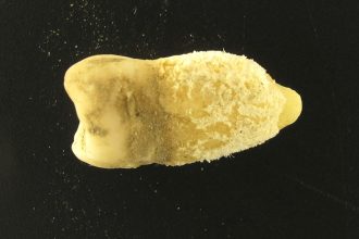 Scientists have reconstructed a 700-year-old strep infection genome from a medieval tooth, revealing the deadly bacteria was infecting humans centuries earlier than previously known.