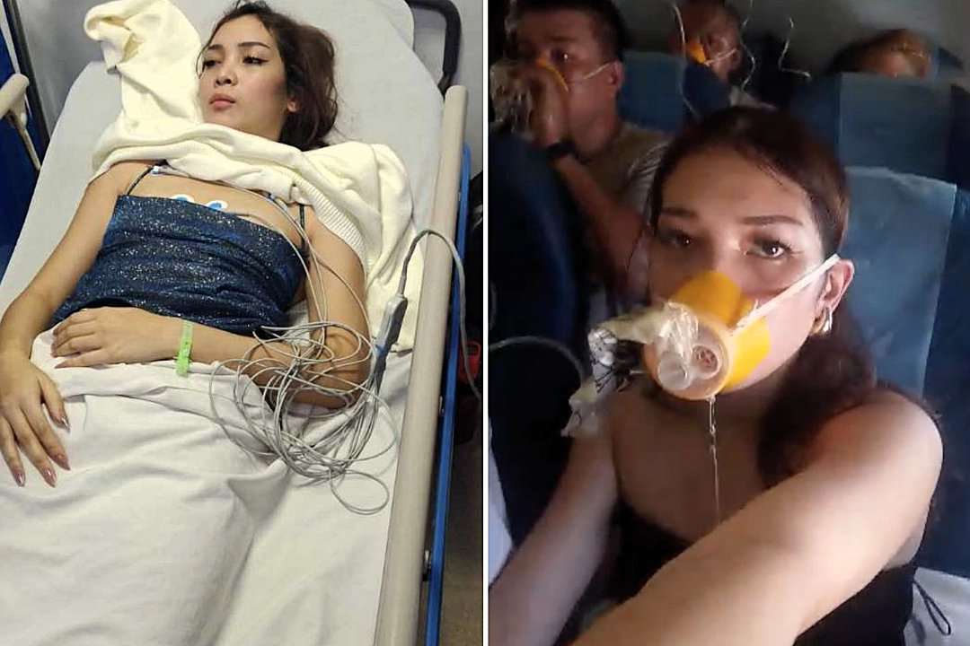 A model was hospitalised with headaches and dizziness after a Philippine Airlines flight suffered a pressurisation failure, forcing an emergency landing with oxygen masks deployed.