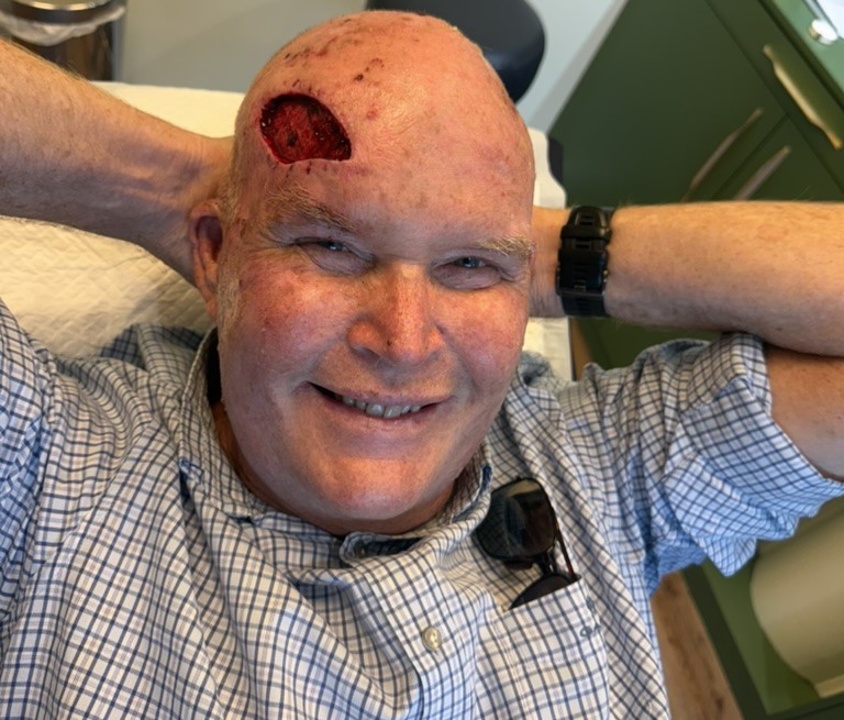 Olympian Oscar Chalupsky was given six months to live after a devastating cancer diagnosis. Seven years later he is still fighting - and refusing to surrender to the disease.