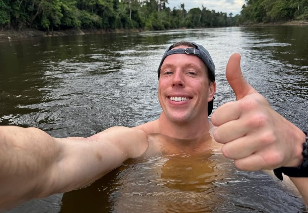 Dutch biologist Freek Vonk showed off deep crocodile bite wounds after being attacked while swimming with saltwater crocodiles in Australia during filming for a children's TV show.