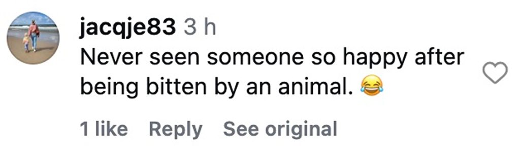 Dutch biologist Freek Vonk showed off deep crocodile bite wounds after being attacked while swimming with saltwater crocodiles in Australia during filming for a children's TV show.