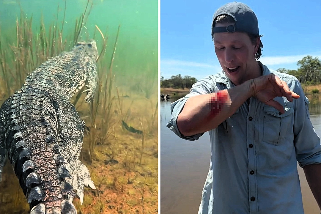 Dutch biologist Freek Vonk showed off deep crocodile bite wounds after being attacked while swimming with saltwater crocodiles in Australia during filming for a children's TV show.