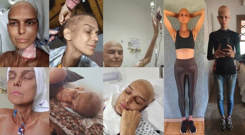 A Voice Brasil star who nearly died from a liver cancer crisis and emergency surgery is crowdfunding her treatment costs - and says she already considers herself a winner.
