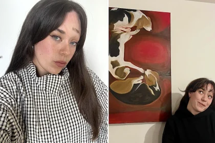 A nurse born with a rare skin condition causing facial folds is silencing trolls and embracing her unique look - with confidence she never expected to find.