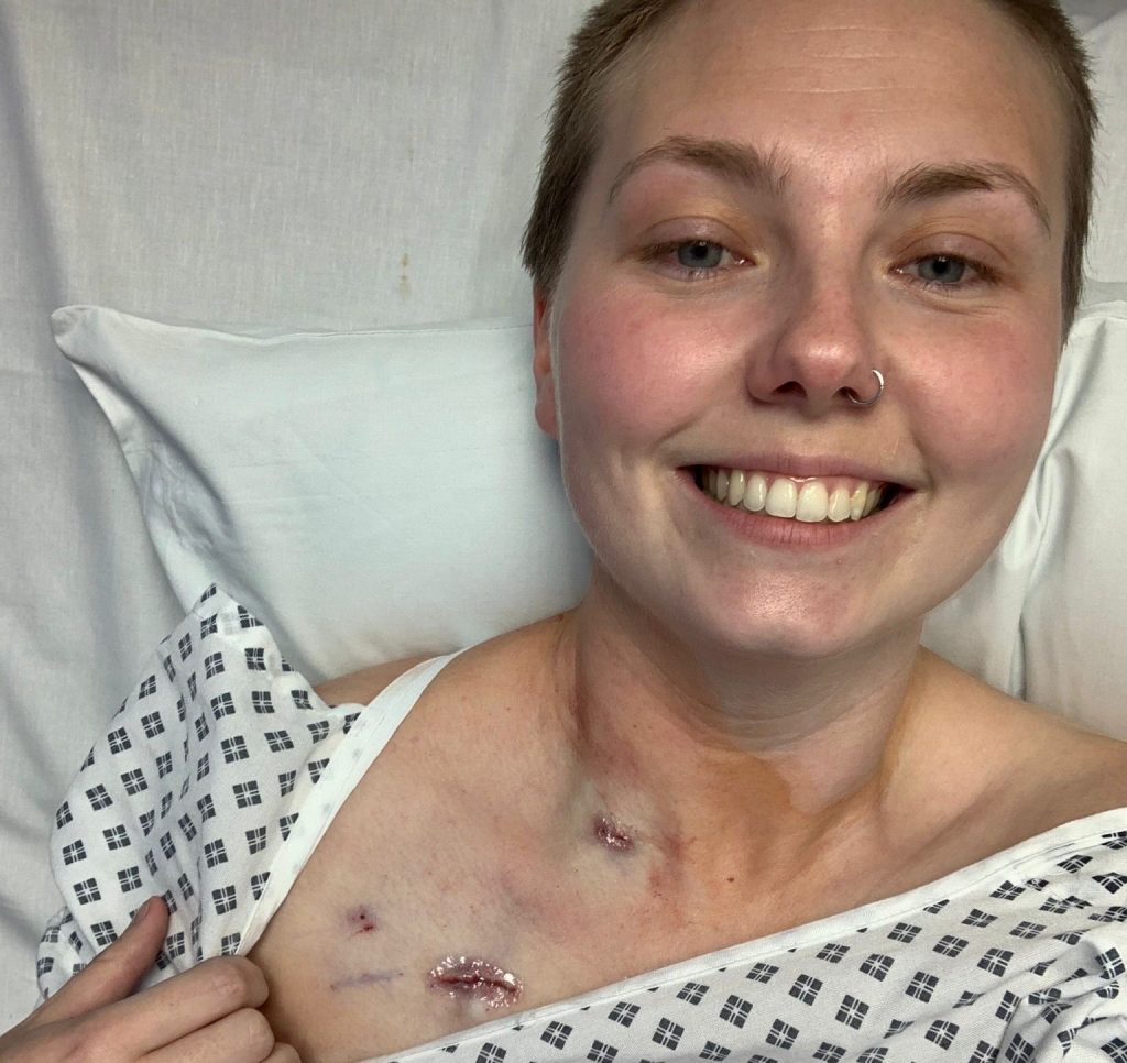 A mum diagnosed with colon cancer says doctors dismissed her early warning signs as piles after giving birth - and is now urging others to push for answers if something feels wrong.